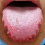 These are the first symptoms of a… See more