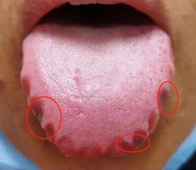 These are the first symptoms of a… See more