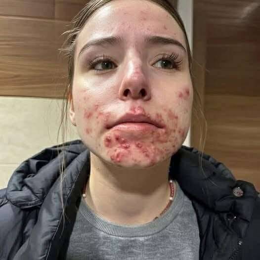 Beyond the Surface: What Your Skin Could Be Telling You About Hidden Health Issues Inside