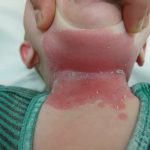 These Are The First Symptoms Of A…