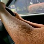 If Your Skin Looks Like This, Here’s What It Really Means