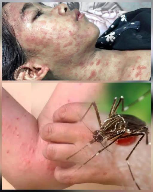 ALERT: New Disease Outbreak in China — Over 7,000 Cases Reported, Symptoms and Risks Revealed…see more