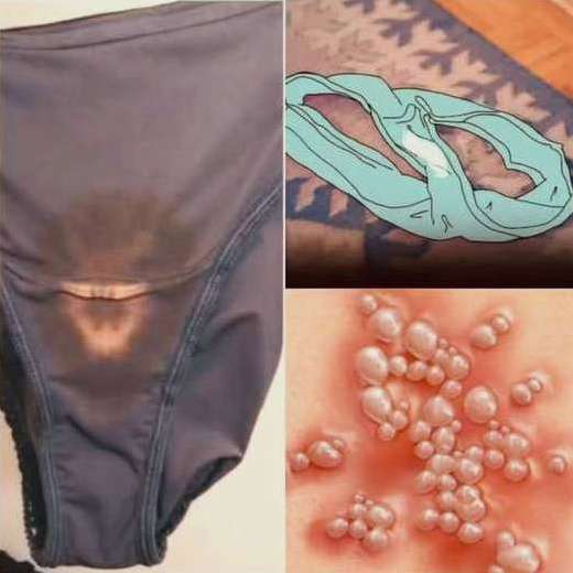 Why You May Notice Bleach-Like Stains on Your Underwear: Causes, Concerns, and When to See a Doctor