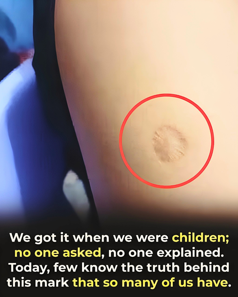 What the small round scar on your arm might indicate